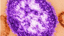 New Jersey officials warn of potential measles exposure at Newark Airport