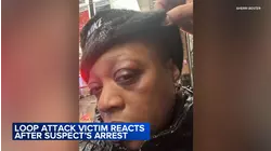 Victim speaks out after alleged serial Loop puncher ordered detained