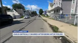 Bridgeport official calls for community to rally around 4-year-old struck by police vehicle