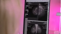 Mammogram screenings declining in key groups of younger women