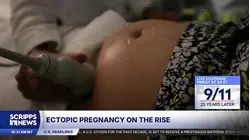 Report finds sharp increase in ectopic pregnancy deaths across the US