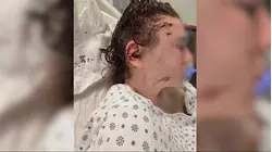 Bronx woman stabbed 22 times waits for justice as suspect remains free