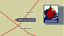 31-year-old man slashed in the arm in Bushwick