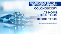 What to know about new colon cancer testing guidelines