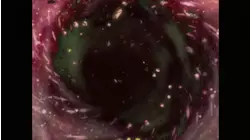 Assault