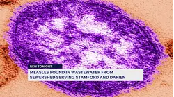 Measles detected in wastewater samples from sewershed serving Stamford and Darien
