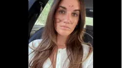 Celebrity esthetician relinquishes license amidst lawsuit