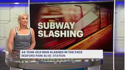 Man slashed in the face at Bedford Park Boulevard station; attacker still at large
