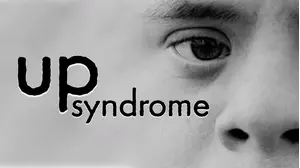 Up Syndrome