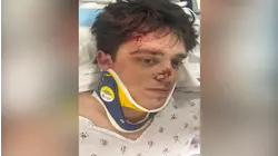 Firefighter recovering as search for hit-and-run driver continues