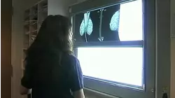 Cada vez más menores de 50 años son diagnosticados con estos tipos de cáncer