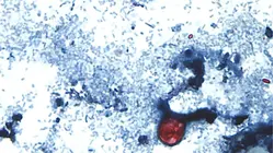Cyclosporiasis outbreak raises new food safety concerns