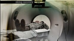 Along Recovery