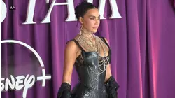 Kim Kardashian's brain aneurysm revelation brings light to the diagnosis