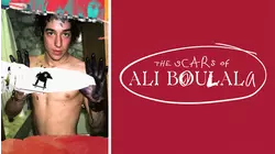 The Scars of Ali Boulala