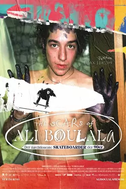 The Scars of Ali Boulala