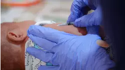 Genera debate la actualización del patrón sobre la vacunación contra hepatitis B en recién nacidos