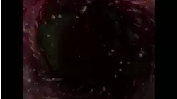 Invasion