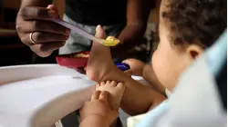 New study examines possible causes of childhood food allergies