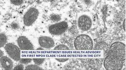 Severe mpox strain detected in NYC