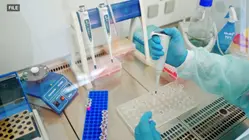 Using AI to help diagnose rare genetic diseases