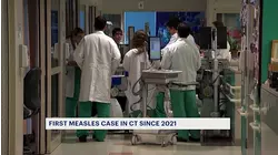 Doctors urge caution, but not panic amid CT's first reported measles case since 2021
