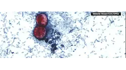 Two deaths linked to Cyclospora outbreak in Michigan