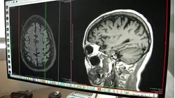 FDA Approves New Blood Test to Identify Signs of Alzheimer's