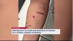 Mother wants answers after pitbull attack in East New York
