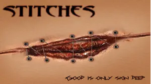 Stitches