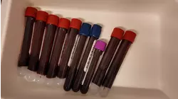 What to know before trying a self-prescribed blood test