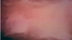 The End of the World