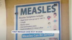 'Can spread like wildfire.' Hartford County adult diagnosed with state's first case of measles this year