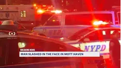 Man slashed in the face outside Mott Haven restaurant