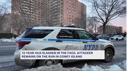 'He was bleeding all over.' 13-year-old boy slashed in the face after argument in Coney Island