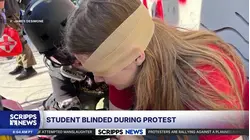 Calif. college student loses eye after federal agent fires projectile during 'No Kings' rally, attorney says
