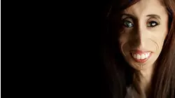 A Brave Heart: The Lizzie Velasquez Story