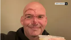 Sen. John Fetterman Back Home From Hospital After Fall