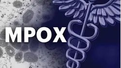 First case of clade I mpox identified in CT