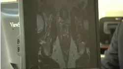 Doctors urging men to take preventative care with health