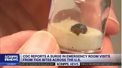 CDC reports surge in ER visits from tick bites