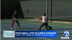 Downside of America's fastest-growing sport? Doctors see surge in pickleball eye injuries