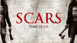 Scars