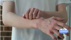 Helpful info for those suffering from chronic hand eczema & sleep disruption