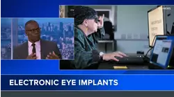 Q&A: Electronic eye implants