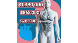 Why Organ Transplants Are So Expensive In The US