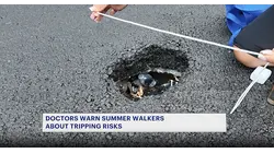Potholes, uneven pavement contribute to rise in summer ankle injuries, doctors say