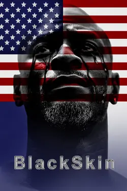 BlackSkin