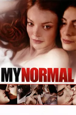 My Normal