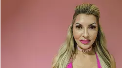 Botox Party Crasher